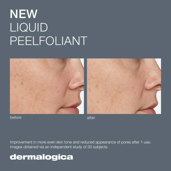DERMALOGICA LIQUID PEELFOLIANT 59ML - Image 4